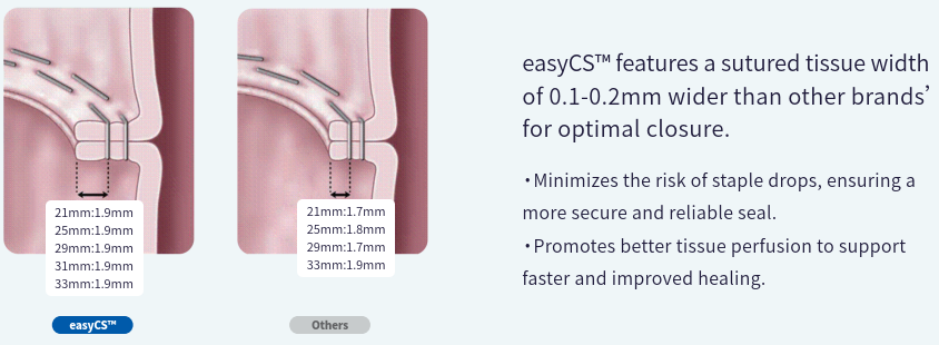 easyCS™