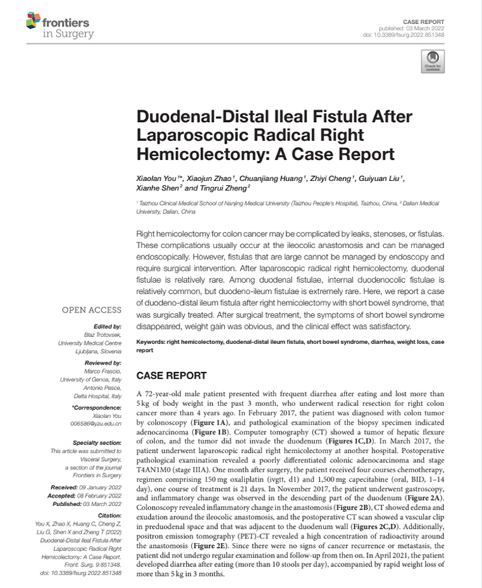 Duodenal-Distal Ileal Fistula After Laparoscopic Radical Right Hemicolectomy A Case Report
