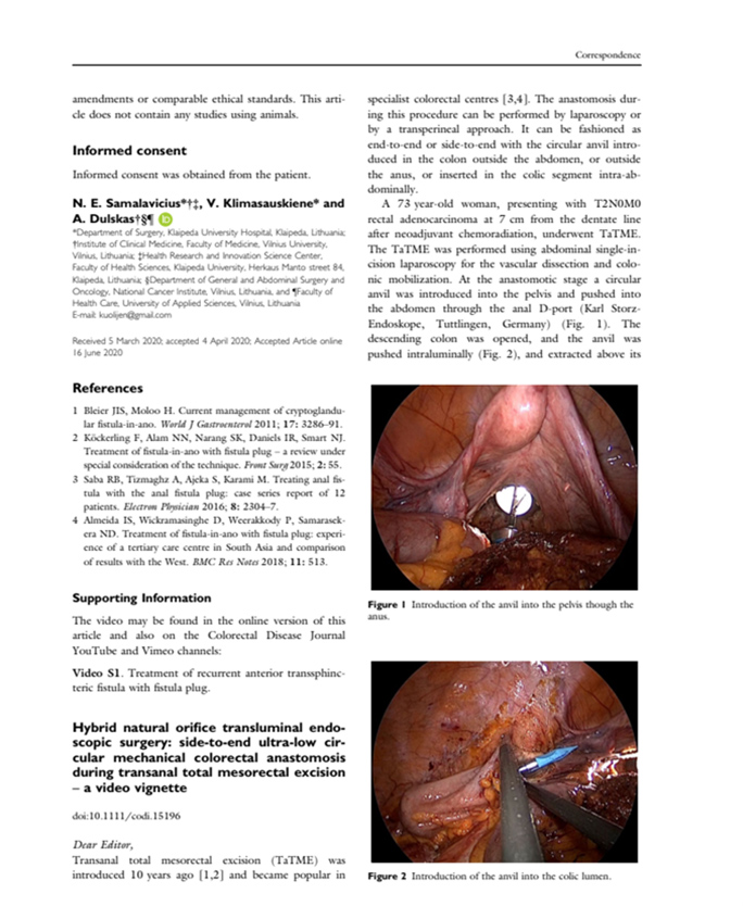 Ezisurg stapler use in colorectal surgery